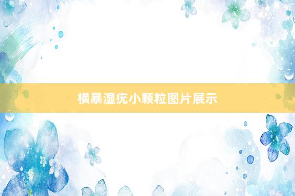 横暴湿疣小颗粒图片展示